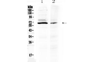 Western blot analysis of AMH using anti- AMH antibody . (AMH 抗体  (AA 75-141))
