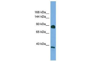 WB Suggested Anti-DLG4 Antibody Titration: 0. (DLG4 抗体  (Middle Region))