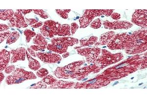 Immunohistochemistry of paraffin-embedded Heart tissue using ROR1 Polyclonal Antibody at dilution of 1:90 . (ROR1 抗体)
