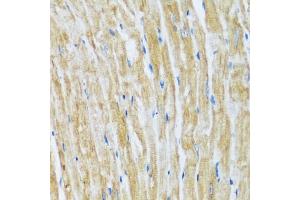 Immunohistochemistry of paraffin-embedded mouse heart using B antibody (ABIN7265851) at dilution of 1:100 (40x lens). (BAG3 抗体  (AA 380-575))