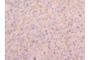 IHC-P analysis of Human Ovary Tissue, with DAB staining. (CD5L 抗体  (AA 133-256))