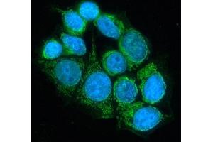 IF analysis of DLD using anti-DLD antibody (ABIN3043561). (DLD 抗体  (AA 300-509))