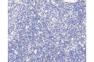 Immunohistochemistry analysis of paraffin-embedded rat thymus using CCR5 Polyclonal Antibody at dilution of 1:300. (CCR5 抗体)
