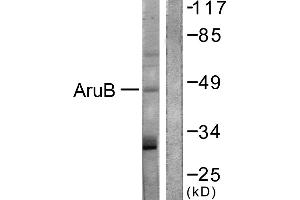 Immunohistochemistry analysis of paraffin-embedded human liver carcinoma tissue using AurB (Ab-12) antibody. (Aurora Kinase B 抗体)
