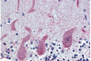 Human Brain, Cerebellum (formalin-fixed, paraffin-embedded) stained with ST18 antibody ABIN462193 followed by biotinylated goat anti-rabbit IgG secondary antibody ABIN481713, alkaline phosphatase-streptavidin and chromogen. (ST18 抗体  (AA 899-948))