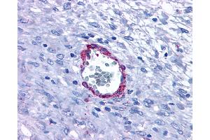Anti-HRH1 / Histamine H1 Receptor antibody IHC of human Vessel. (HRH1 抗体  (Extracellular Domain))