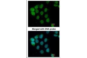 ICC/IF Image Immunofluorescence analysis of paraformaldehyde-fixed A431, using ARAF, antibody at 1:200 dilution. (ARAF 抗体  (C-Term))