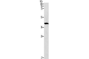 Western blot analysis of Mouse brain tissue using ZADH2 Polyclonal Antibody at dilution of 1:1000 (ZADH2 抗体)