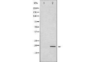 Western Blotting (WB) image for anti-Cofilin 1 (CFL1) (pSer3) antibody (ABIN6255180)