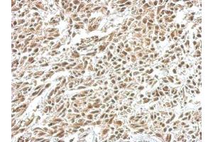 Immunohistochemistry (IHC) image for anti-Nuclear Factor of kappa Light Polypeptide Gene Enhancer in B-Cells Inhibitor, alpha (NFKBIA) (Center) antibody (ABIN2856763)