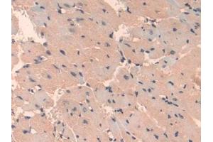 Immunohistochemistry (IHC) image for anti-Serpin Family A Member 7 (SERPINA7) (AA 127-393) antibody (ABIN7429166)