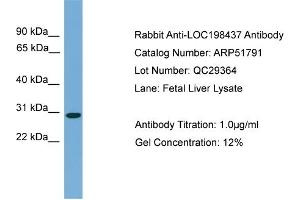 WB Suggested Anti-C20orf201  Antibody Titration: 0. (C20orf201 抗体  (C-Term))