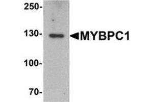 Western blot analysis of MYBPC1 in rat skeletal muscle tissue lysate with MYBPC1 antibody at 1 ug/mL. (MYBPC1 抗体  (N-Term))