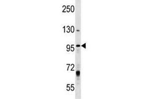 MCM8 antibody western blot analysis in T47D lysate. (MCM8 抗体  (AA 322-350))