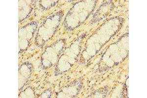 Immunohistochemistry of paraffin-embedded human colon tissue using ABIN7159692 at dilution of 1:100 (APOOL 抗体  (AA 163-268))