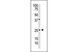 Western Blotting (WB) image for anti-Platelet Derived Growth Factor Subunit B (PDGFB) (AA 212-241), (C-Term) antibody (ABIN388460)