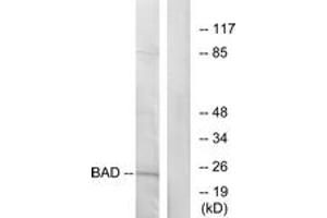 Western blot analysis of extracts from 293 cells, treated with Forskolin, using BAD (Ab-155) Antibody. (BAD 抗体  (AA 119-168))