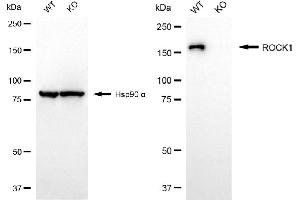 Western blotting analysis using ROCK1 antibody (ABIN7800204). (Recombinant ROCK1 抗体)