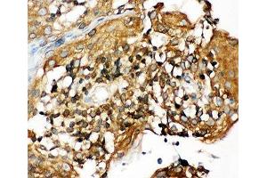 IHC-P: NLRP3 antibody testing of human tonsil tissue (NLRP3 抗体  (N-Term))