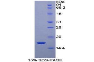 SDS-PAGE (SDS) image for Retinol Binding Protein 5, Cellular (RBP5) (AA 1-135) protein (His tag) (ABIN1080662) (Retinol Binding Protein 5 Protein (AA 1-135) (His tag))