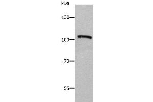 Western Blot analysis of Human fetal brain tissue using ADAMTS5 Polyclonal Antibody at dilution of 1:650 (ADAMTS5 抗体)