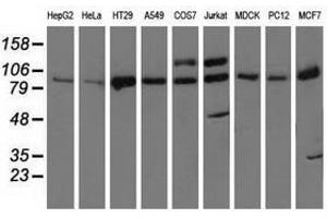 Image no. 2 for anti-Protein Kinase D2 (PKD2) antibody (ABIN1500413)