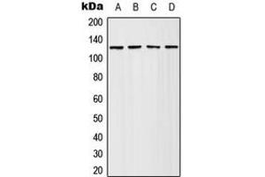 Western blot analysis of Adenylate Cyclase 4 expression in HeLa (A), Jurkat (B), SP2/0 (C), PC12 (D) whole cell lysates. (ADCY4 抗体  (Center))