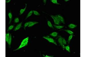 Immunofluorescent analysis of Hela cells using ABIN7170416 at dilution of 1:100 and Alexa Fluor 488-congugated AffiniPure Goat Anti-Rabbit IgG(H+L) (SP11 (AA 137-386) 抗体)
