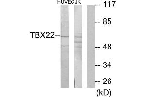 Western blot analysis of extracts from HUVEC cells and Jurkat cells, using TBX22 antibody. (T-Box 22 抗体  (N-Term))