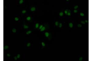 Immunofluorescence staining of MCF7 Cells with ABIN7127589 at 1:50, counter-stained with DAPI. (Recombinant JunB 抗体)