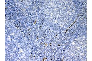 IHC analysis of IL33 using anti-IL33 antibody . (IL-33 抗体  (AA 95-270))