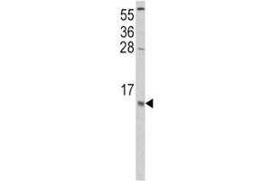 Western blot analysis of CCL2 antibody and HeLa lysate. (CCL2 抗体  (AA 62-89))
