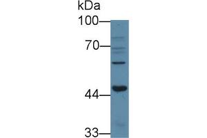Western blot analysis of Human 293T cell lysate, using Human ACVR1B Antibody (3 µg/ml) and HRP-conjugated Goat Anti-Rabbit antibody ( (Activin A Receptor Type IB/ALK-4 抗体  (AA 24-126))