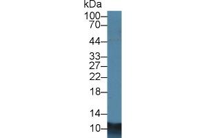 Western Blotting (WB) image for anti-S100 Calcium Binding Protein A8 (S100A8) (AA 1-89) antibody (ABIN7443995)