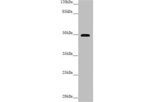 PSTPIP1 抗体  (AA 157-416)