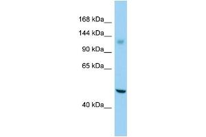 Host: Rabbit Target Name: GPR158 Sample Type: Jurkat Whole Cell lysates Antibody Dilution: 1.