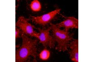 Immunofluorescence of human HeLa cells stained with monoclonal CLEC4E monoclonal antibody, clone AT16E3  (1 : 500) with Texas Red (Red).