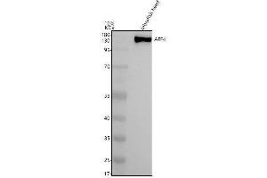 Western blot analysis of AFF4 using anti-AFF4 antibody (AZA0A8N7TEI3).