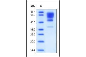 Human CADM1, His Tag on SDS-PAGE under reducing (R) condition. (CADM1 Protein (AA 45-374) (His tag))