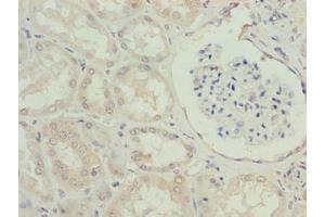 Immunohistochemistry of paraffin-embedded human kidney tissue using ABIN7151406 at dilution of 1:100 (EFCAB12 抗体  (AA 1-200))