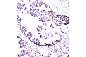 IHC analysis of cortactin using anti-cortactin antibody (ABIN6719306). (Cortactin 抗体  (AA 1-105))