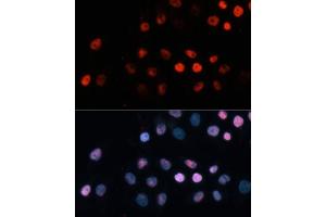 Immunofluorescence analysis of HeLa cells using TET1 Polyclonal Antibody (ABIN3022030, ABIN3022031, ABIN3022032, ABIN1513597 and ABIN6218576) at dilution of 1:100 (40x lens). (TET1 抗体)