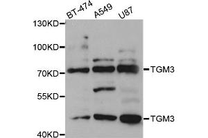 Western blot analysis of extracts of various cell lines, using TGM3 antibody. (TGM3 抗体)