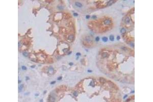 Used in DAB staining on fromalin fixed paraffin- embedded Kidney tissue (OCEL1 抗体  (AA 1-109))