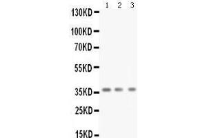 Anti-BDNF antibody, Western blotting All lanes: Anti BDNF  at 0.