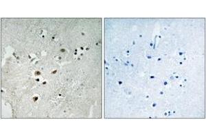 Immunohistochemistry (IHC) image for anti-ELK3, ETS-Domain Protein (SRF Accessory Protein 2) (ELK3) (AA 323-372), (pSer357) antibody (ABIN1531595)