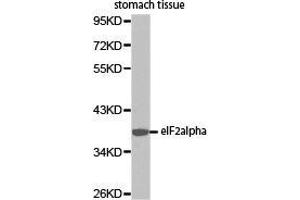 Western Blotting (WB) image for anti-Eukaryotic Translation Initiation Factor 2 Subunit 1 (EIF2S1) antibody (ABIN2650910) (EIF2S1 抗体)