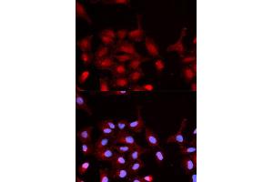 Immunofluorescence analysis of MCF-7 cells using Phospho-ABL1-Y245 antibody (ABIN5969865). (ABL1 抗体  (pTyr245))