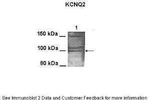 Lanes:   100 ug CHO cell lysate  Primary Antibody Dilution:   1:1000  Secondary Antibody:   Goat anti-rabbit HRP  Secondary Antibody Dilution:   1:25000  Gene Name:   KCNQ2  Submitted by:   Anonymous (KCNQ2 抗体  (N-Term))