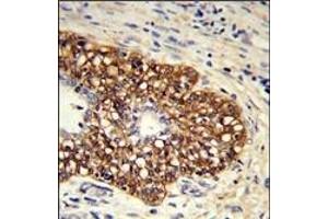 Immunohistochemistry (Paraffin-embedded Sections) (IHC (p)) image for anti-Prostaglandin I2 (Prostacyclin) Synthase (PTGIS) (AA 472-500), (C-Term) antibody (ABIN652421)